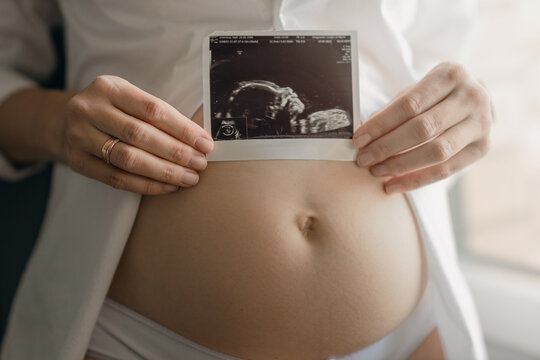 Woman holding an ultrasound scan of her unborn baby