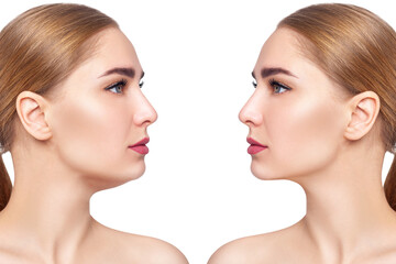 Young woman before and after chin correction. Over white background. - obrazy, fototapety, plakaty