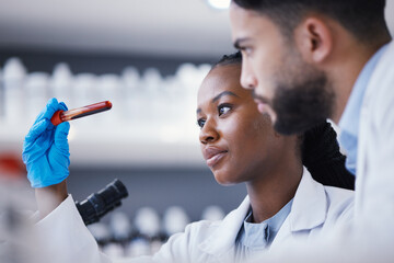 Science, blood test and team of scientists in lab working on medical experiment, study or exam....