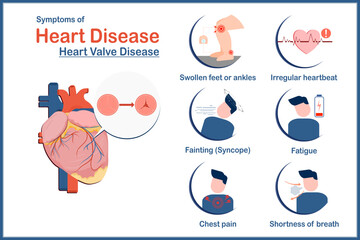 Medical illustration vector concept,symptoms of heart disease caused by heart valve disease.swollen feet or ankles,irregular heartbeat,fatigue,Shortness of breath,fainting or syncope flat style.