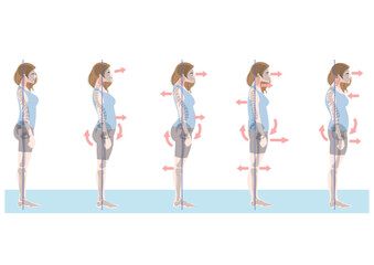 Naklejka premium 横から見た不良姿勢の女性セット