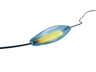 mesh metal nitinol self-expandable stent 3D rendering for endovascular surgery isolated on transparent background.