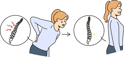 Woman with sick spine near healthy girl with good posture who underwent chiropractic procedure