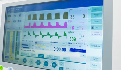 Hospital monitor displaying vital signs: heart rate, blood pressure, pulse oximetry, temperature. Symbolizing health monitoring and medical care