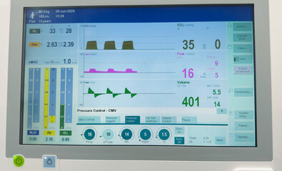 Hospital monitor displaying vital signs: heart rate, blood pressure, pulse oximetry, temperature. Symbolizing health monitoring and medical care