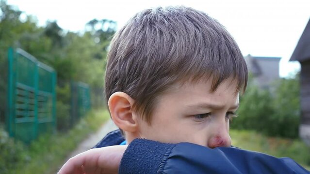 Rising from the Pain: Determined Boy with Wounds on His Face Gathers Strength to Seek Revenge, Wiping the Blood Off His Face