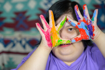 Asian girl with down syndrome watercolor and hand painted Young woman with Down syndrome happy...