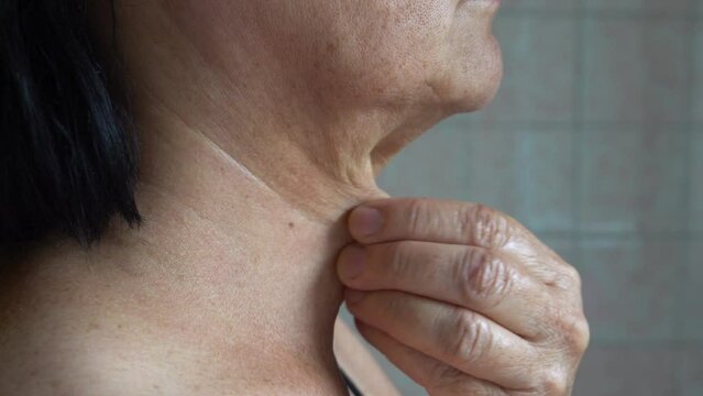 sagging skin on the neck of an elderly woman.