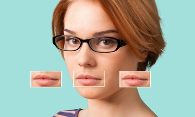 Hyaluronic injection concept. Beautiful Women lips