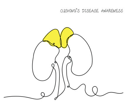illustration of Cushing disease awareness