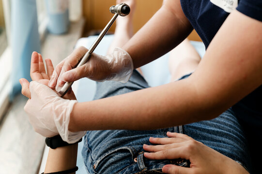 Appointment with a neurologist. medical checkup. neurologist allergic reactions with a hammer