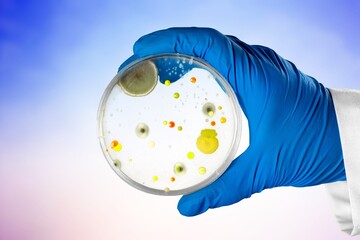 colonies of bacteria growing on agar plate