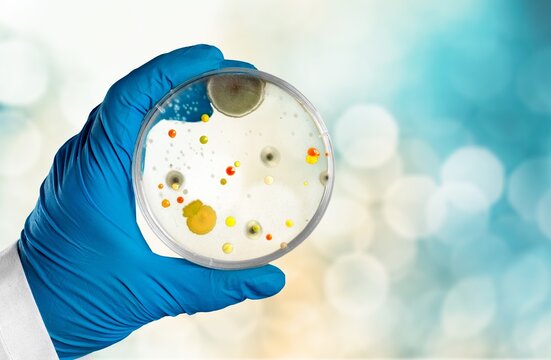 colonies of bacteria growing on agar plate