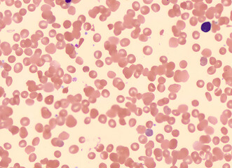Red Blood Cells