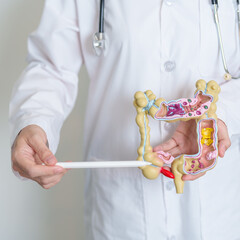 Doctor holding human Colon anatomy model. Colonic disease, Large Intestine, Colorectal cancer,...