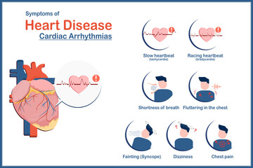 Medical illustration concept, heart disease symptoms caused by irregular heartbeat or cardiac arrhythmias, fatigue, tachycardia, bradycardia, dizziness, chest pain and syncope, flat style