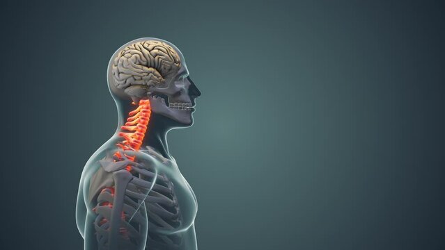 Neck pain or Cervical posture syndrome medical animation