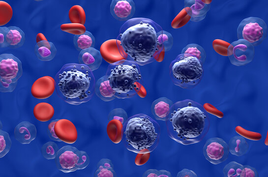 Acute myeloid leukemia (AML) cells in blood flow - isometric view 3d illustration