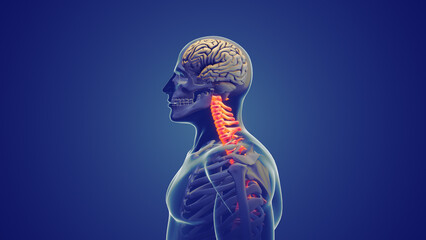 Neck pain or Cervical posture syndrome