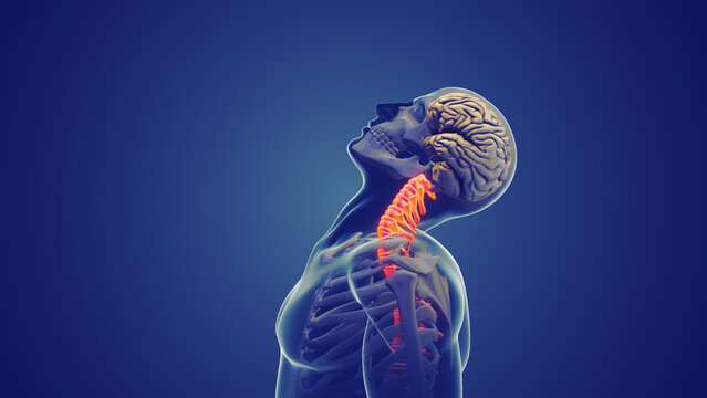 Neck pain or Cervical posture syndrome