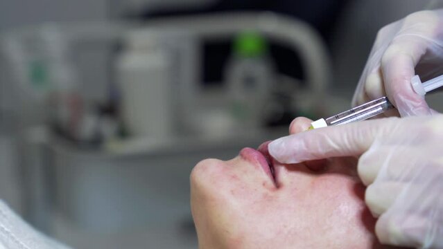 Beautician doctor makes botox injection in the lips of young beauutiful wpman. Extreme close up 4k shot