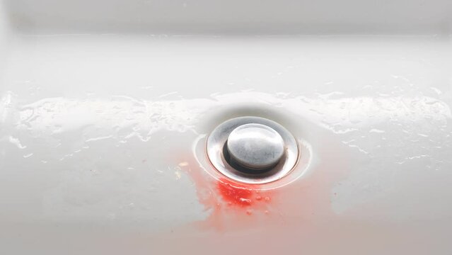 Blood clot in the sink. Problem with gums.