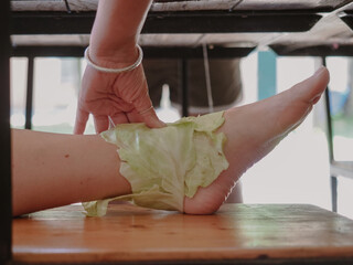 woman wearing anti inflammatory cabbage leaves compress in foot.