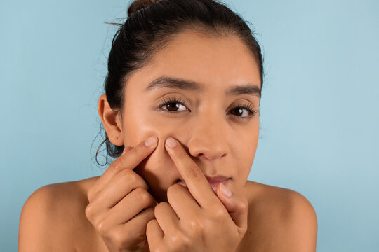 Young lady popping pimples on cheeks on blue background