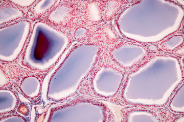 Showing Light micrograph of the Thyroid gland and Thymus gland human Child under the microscope for education in the laboratory.