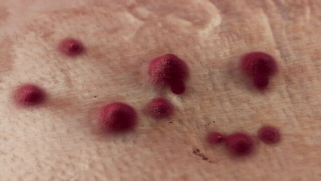 Acne Spreading. Multiplication of Zits - Skin and Health Issues. Macro 3D Render