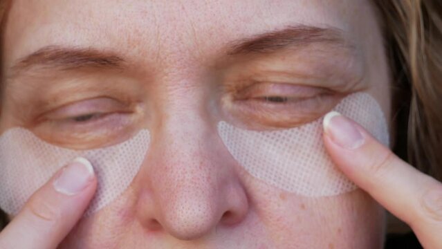 middle aged female's eye with drooping eyelid with patch for eyes. Ptosis is a drooping of the upper eyelid, lazy eye. Cosmetology and facial concept, first wrinkles