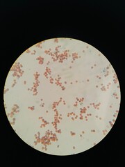 photo of yeasts spores and mycelium under the microscope
