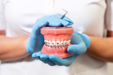 Close-up dentist hands in medical gloves hold plaster human jaw layout using plugger, describe...