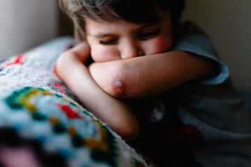 Little boy shows skinned elbow