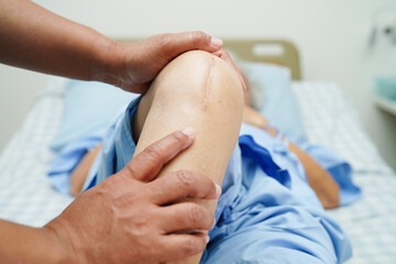 Doctor checking Asian elderly woman patient with scar knee replacement surgery in hospital.