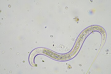 soil switcher nematode, microorganism and soil biology, with nematodes and fungi under the microscope. in a soil and compost sample