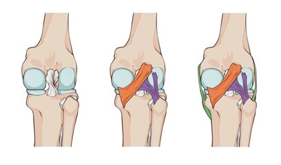 knee ligaments and menisci, with oblique popliteal ligament, medial fascicle of arcuate popliteal ligament, lateral fascicle of arcuate popliteal ligament and tibial collateral ligament 