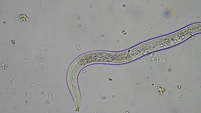 nematode microorganisms and soil biology, with nematodes and fungi under the microscope. in a soil and compost sample on a farm in australia