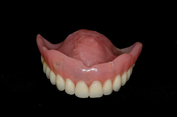 Close-up human denture of the upper jaw on a black background - obrazy, fototapety, plakaty
