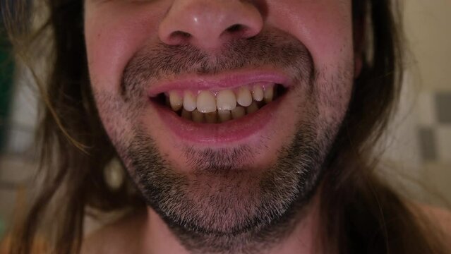 Close up of man with long hair and unshaved beard hair smiling exposing his slightly yellow teeth.