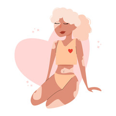 Young woman with vitiligo,self love concept. Positive body and mental health concept.