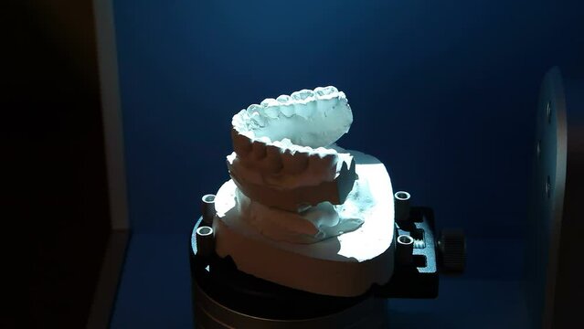 canning of the impression of the teeth for further printing on the printer. Dental prosthesis, dentures, prosthetics work.
