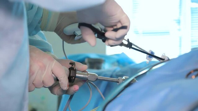 Surgeons team hands during laparoscopic abdominal operation. Operation using endoscopic equipment. 