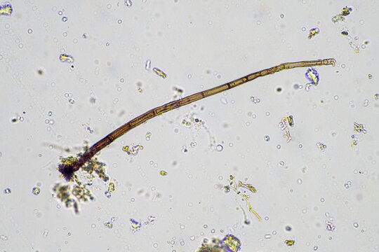 fungal hyphae under the microscope