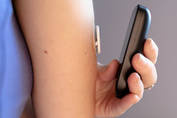 Female hand with continuous glucose monitor showing glucose level