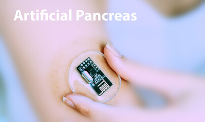 Artificial Pancreas Implantable Electronic Medical Devices Concept
