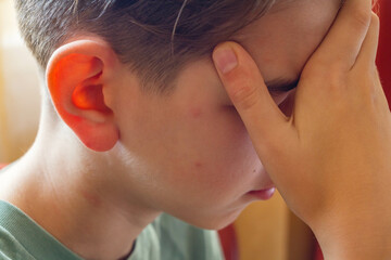 Sad boy holding his head by his hand bitten by mosquitos