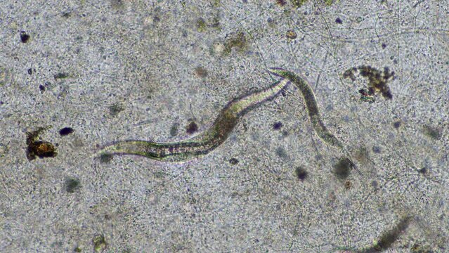 nematodes and fungi under the microscope. in a soil and compost sample on a farm in australia