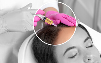 Cosmetologist does prp therapy against hair loss and anti-dandruff of a beautiful woman in a beauty salon. Cosmetology concept.
