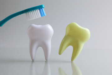 Dentistry concept. Model of a tooth and dental instruments on a light background with space for text. 